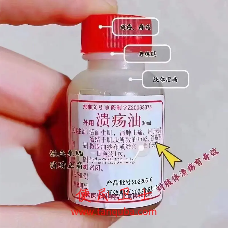 北京协和医院 溃疡油